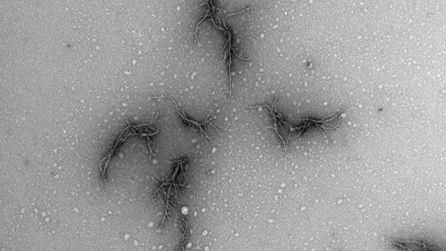 Electron microscopy image showing amyloid of corona virus spike protein.