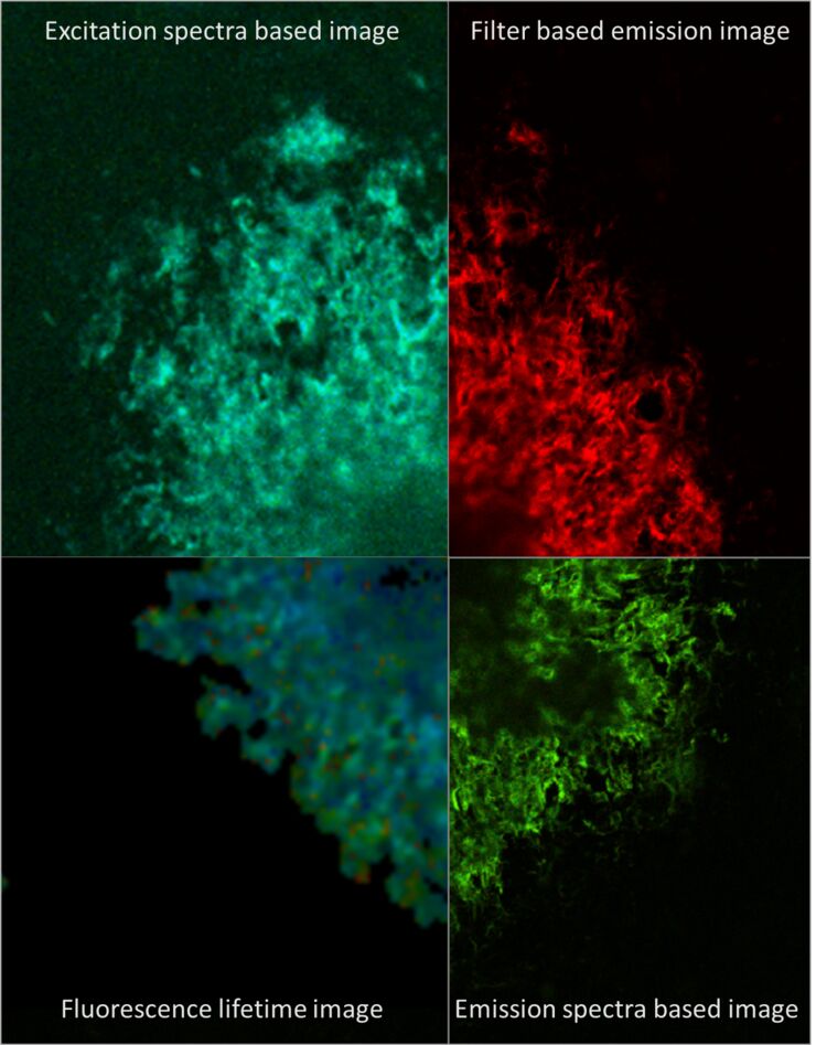 differences in amyloid plaques with high resolution and specificity