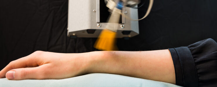 Fotografi av en robotarm som stryker en pensel över en persons arm
