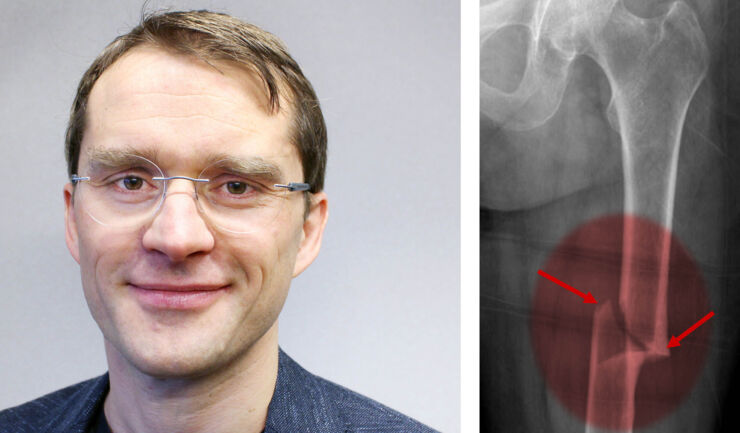 porträttfoto, manlig forskare och röntgenbild på lårbensbrott.