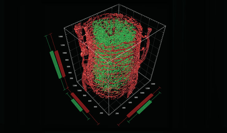 3D-visualiserad, infekterad mustarm.