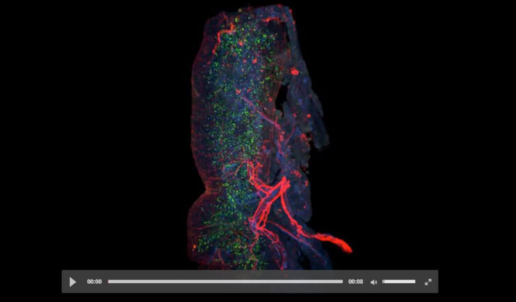 3D-visualiserad, infekterad mustarm.