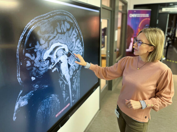 Kvinna pekar på en skärm som visar upp en film på en hjärna.
