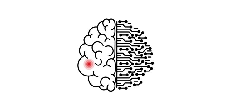 Gaphics showing a human brain with a red highlighted sport