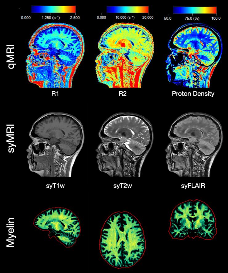 Brain images of a 33 years old patient