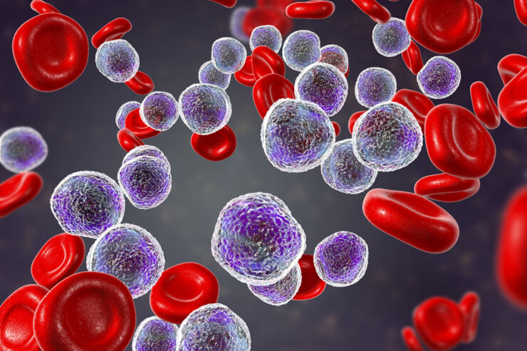 leukemia cells vs normal cells