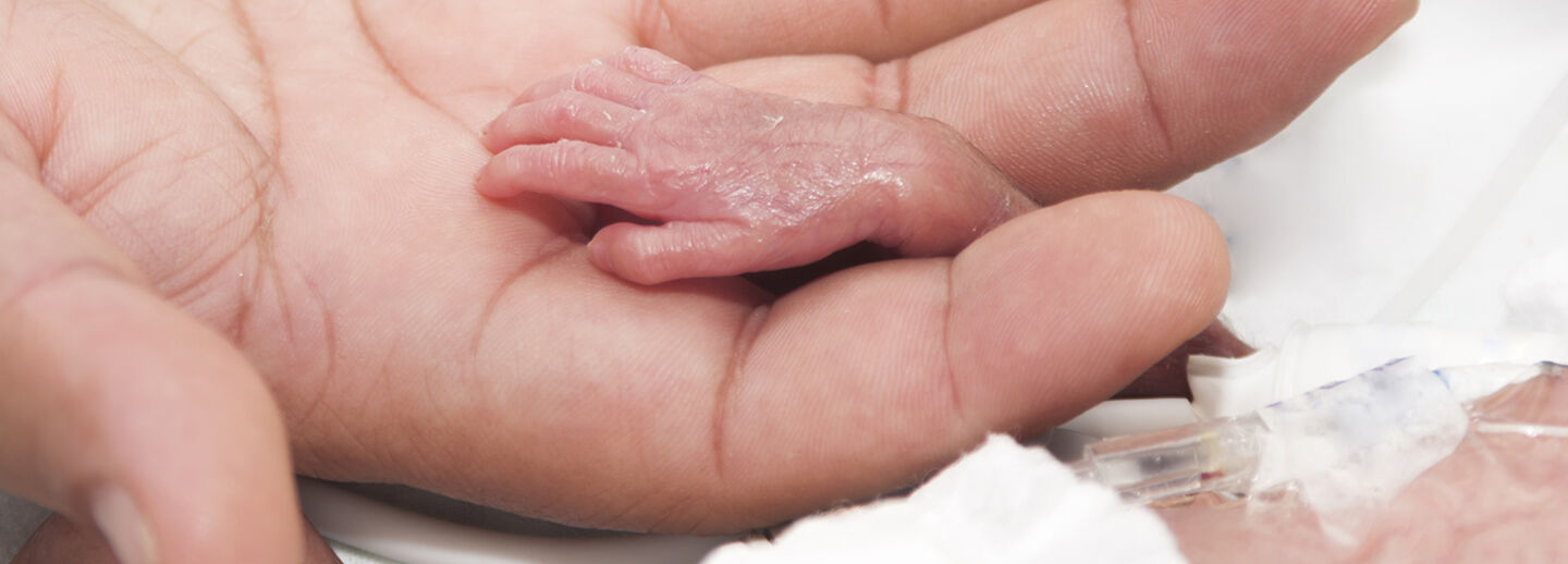 adult hand holding the hand of a prematurely born baby.