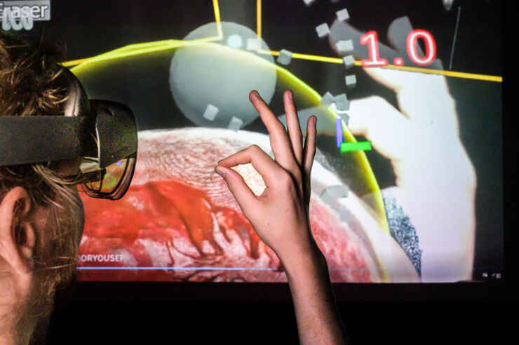 Digital autopsies with 3D visualisation technology - Linköping University