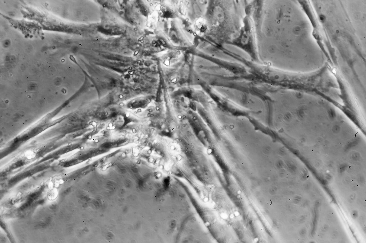 Benceller i närbild.