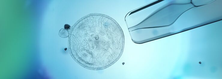 Stem cell.