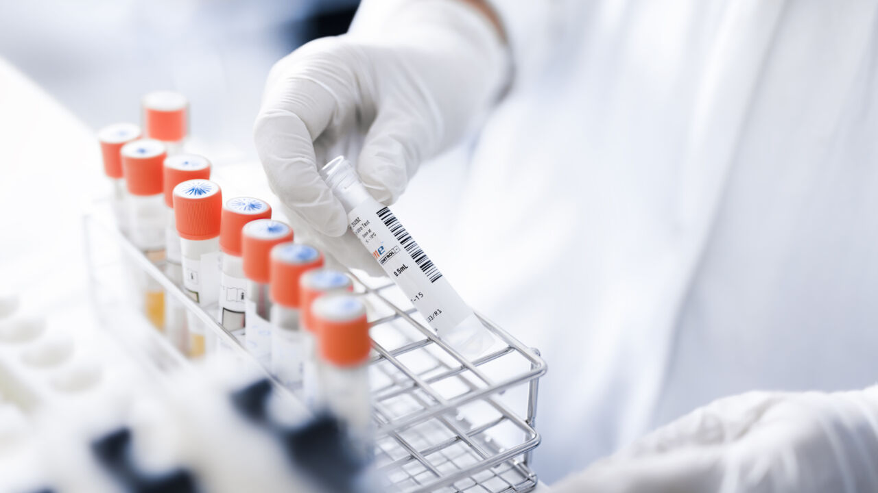 Person holding a test tube.