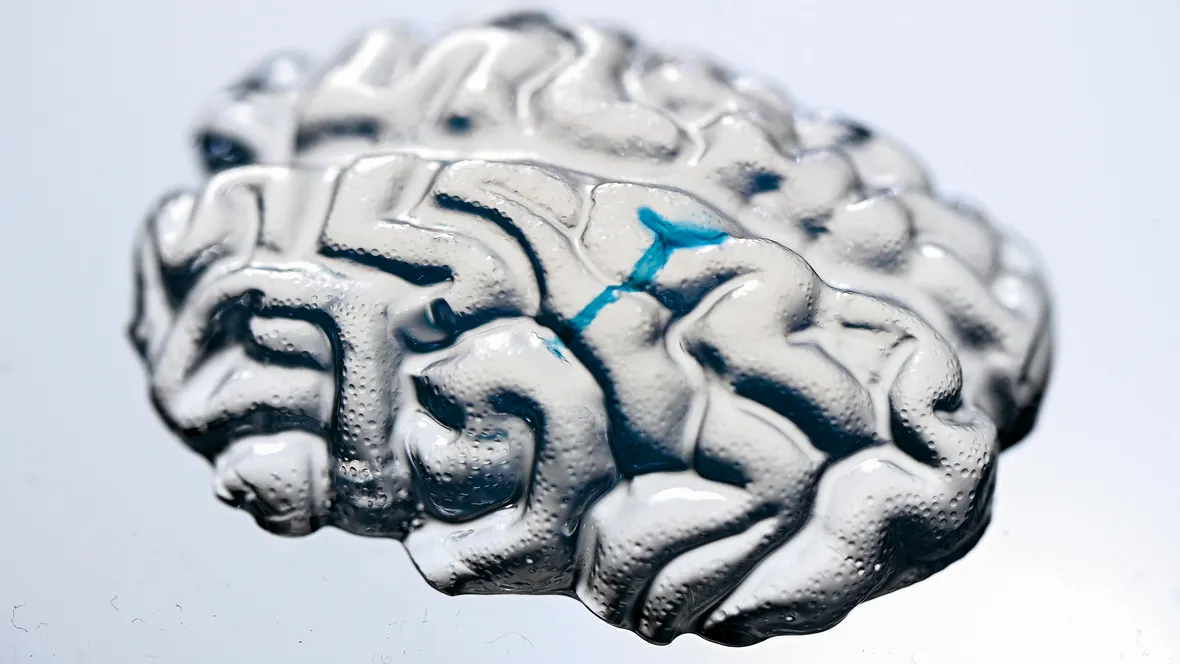 A miniature model of a brain made by gel.