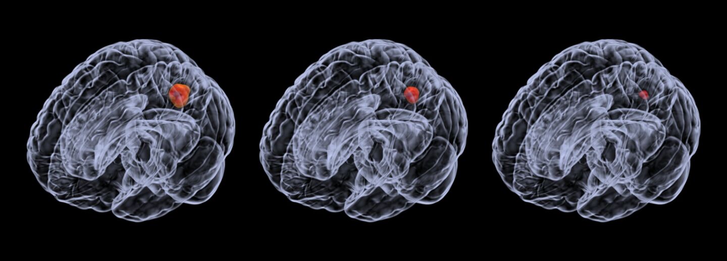 En grafisk bild av den mänskliga hjärnan