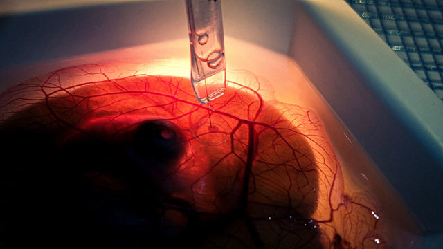 Iontronic pump in thin blood vessels.