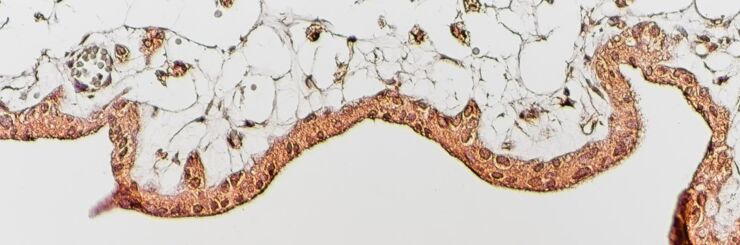 Immunreglering vid tolerans (graviditet) och inflammation (multipel skleros)