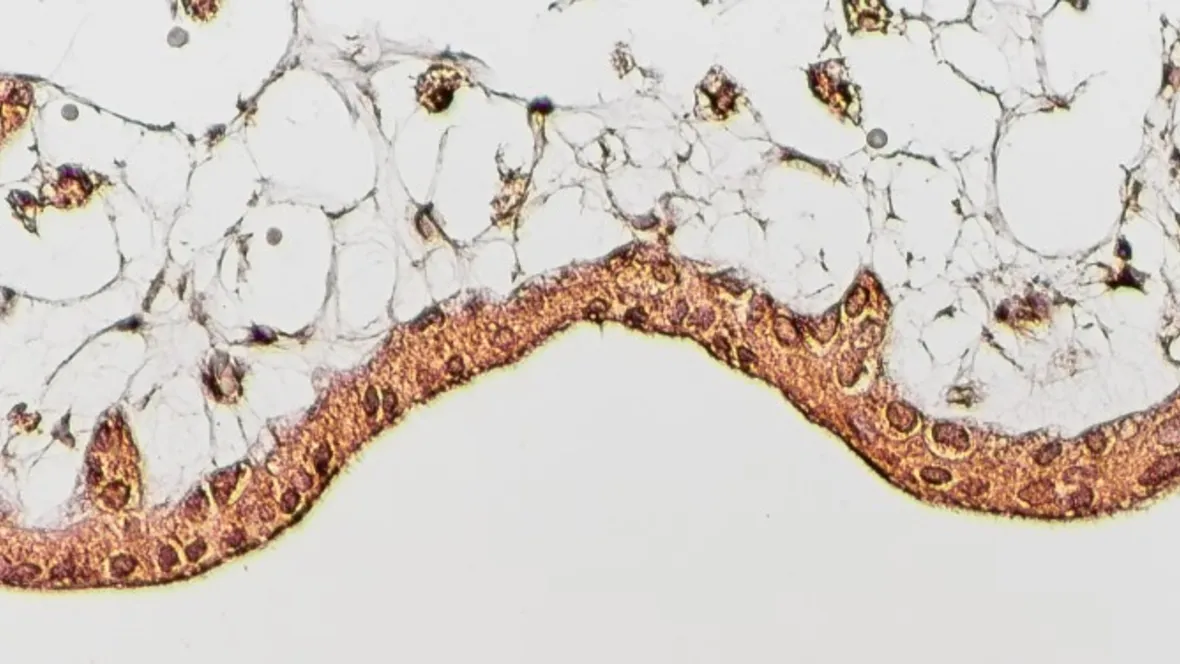 Immunreglering vid tolerans (graviditet) och inflammation (multipel skleros)