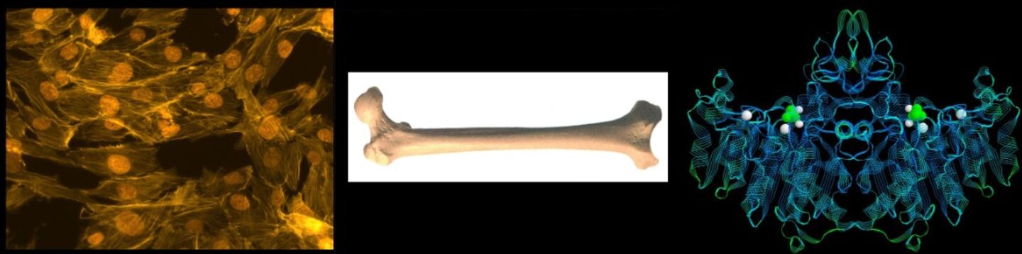 Bone, mineralization and vascular calcification.