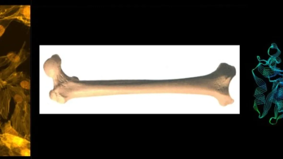 Bone, mineralization and vascular calcification.