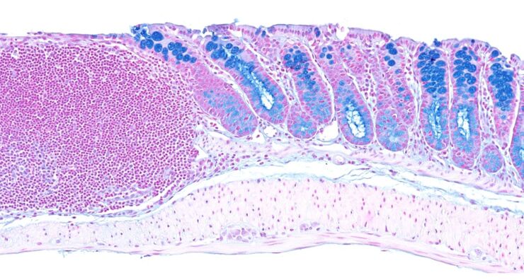 Cell signaling in inflammation and cancer.