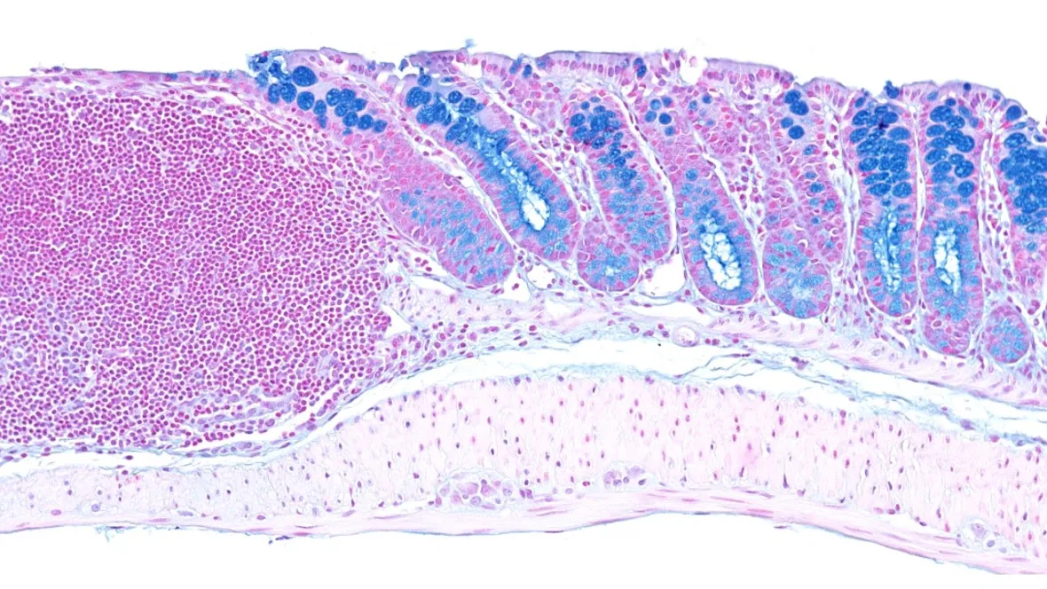 Cell signaling in inflammation and cancer.