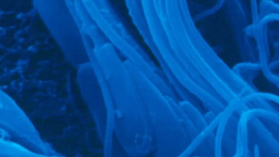 Doesn't one sperm suffice?