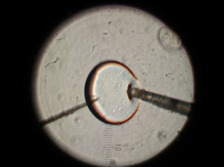 Closeup of a droplet under the microscope