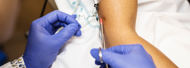 a thin electrode is inserted into the arm