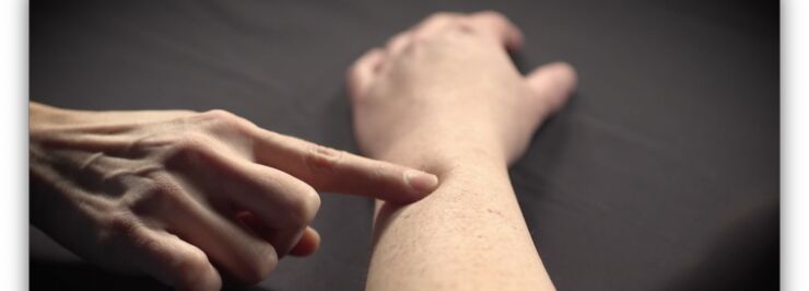 A finger presses on a person's arm.