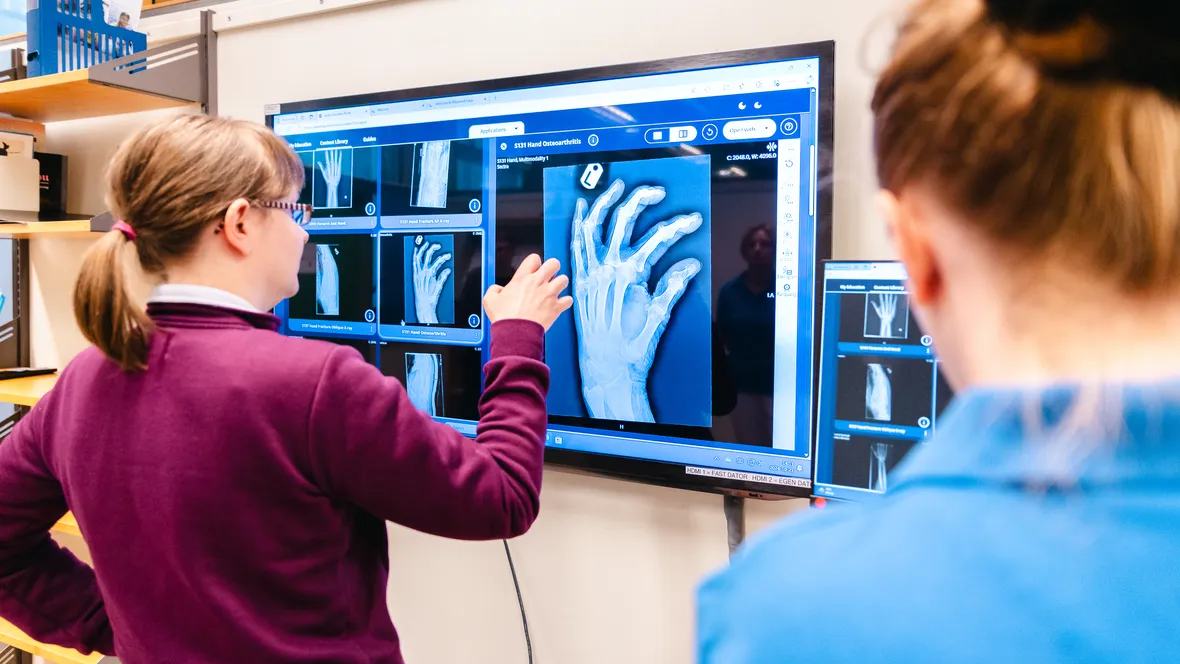 Två studenter tittar på röntgenbilder av händer. 